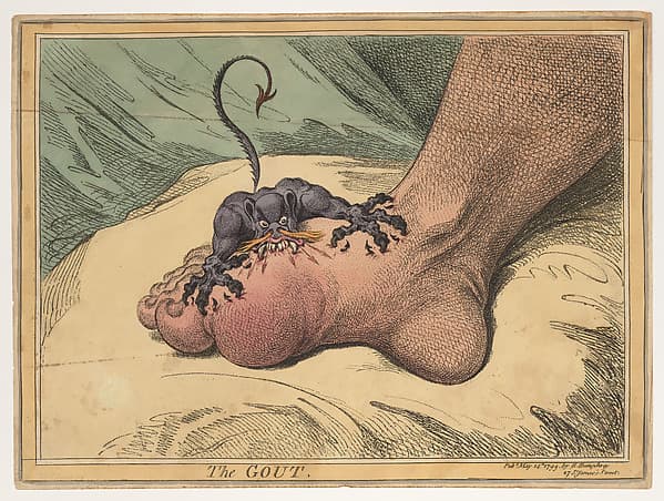 The Gout, by James Gillray