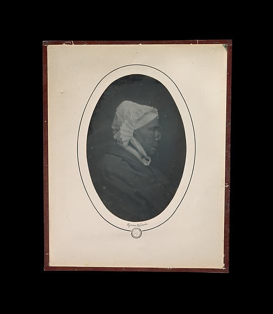 [Profile of a Woman with Necrosis of the Nose], by Louis-Auguste Bisson
