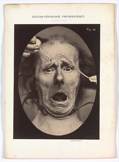 Electro–Physiologie, Figure 64, by Adrien Tournachon