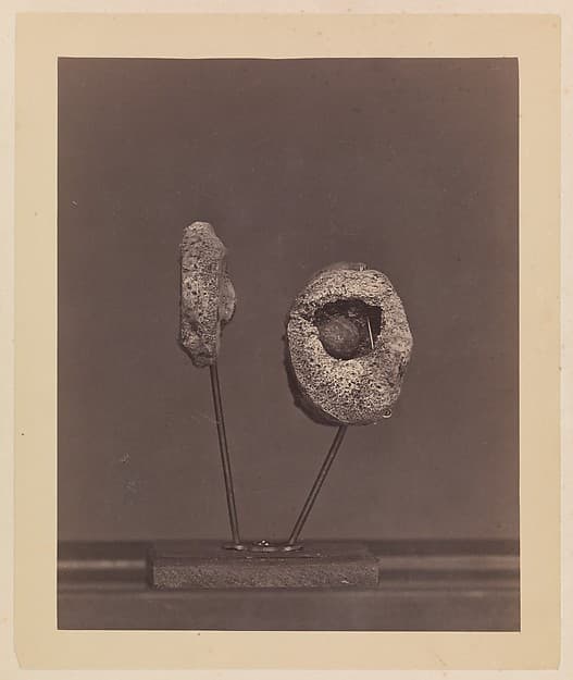 Excised Knee Joint. A Round Musket Ball in the Inner Condyle of the Right Femur [Gardiner Lewis, Company B, Nineteenth Indiana Volunteers], by William H. Bell