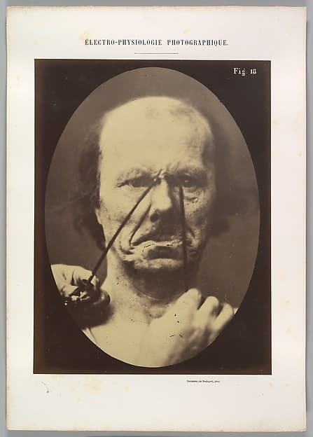 Figure 18: Aggression, wickedness, by Guillaume-Benjamin-Amand Duchenne de Boulogne