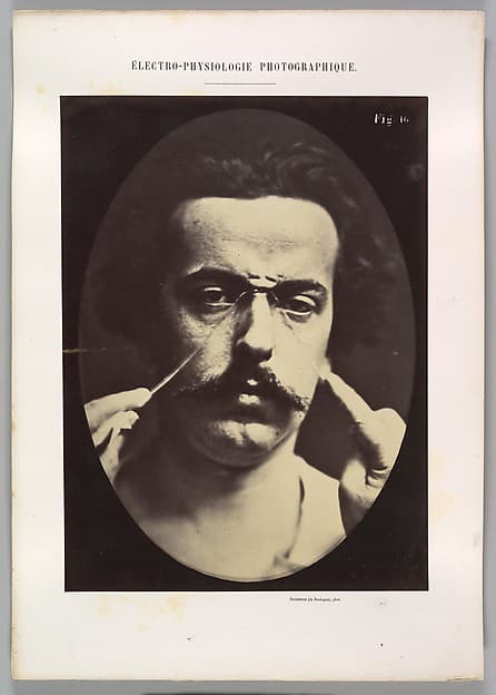 Figure 16: Expression of severity, by Guillaume-Benjamin-Amand Duchenne de Boulogne