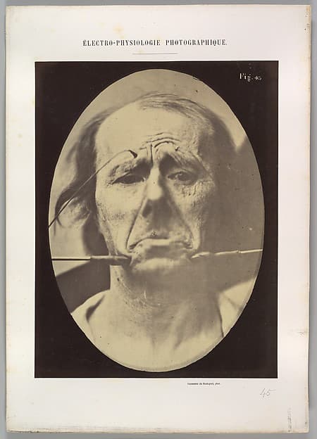 Figure 45: Pain and despair., by Guillaume-Benjamin-Amand Duchenne de Boulogne