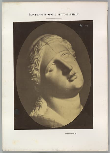 Figure 73: Head of Niobe, by Guillaume-Benjamin-Amand Duchenne de Boulogne