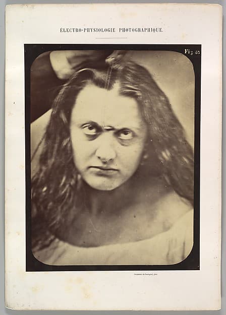 Figure 83: Lady Macbeth, ferocious cruelty, by Guillaume-Benjamin-Amand Duchenne de Boulogne