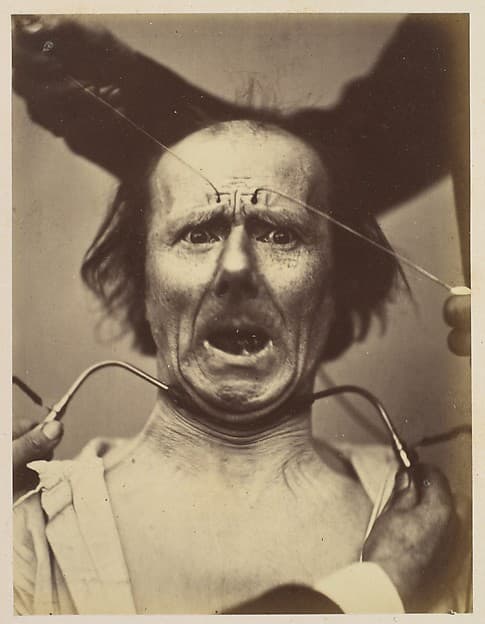 Icono-photographique. Mécanisme de la Physionomie Humaine. Fig. 65, by Guillaume-Benjamin-Amand Duchenne de Boulogne