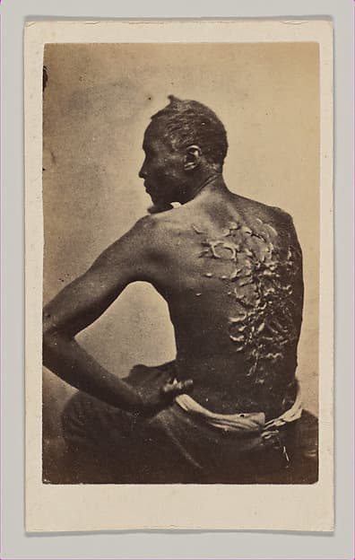 Gordon, A Runaway Mississippi Slave, or "The Scourged Back", by McPherson & Oliver