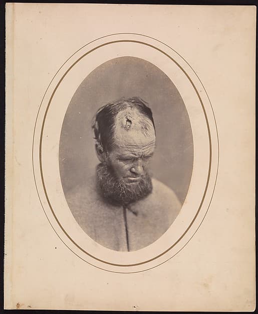 Private John Parkhurst, Company E, Second New York Heavy Artillery, by Reed Brockway Bontecou