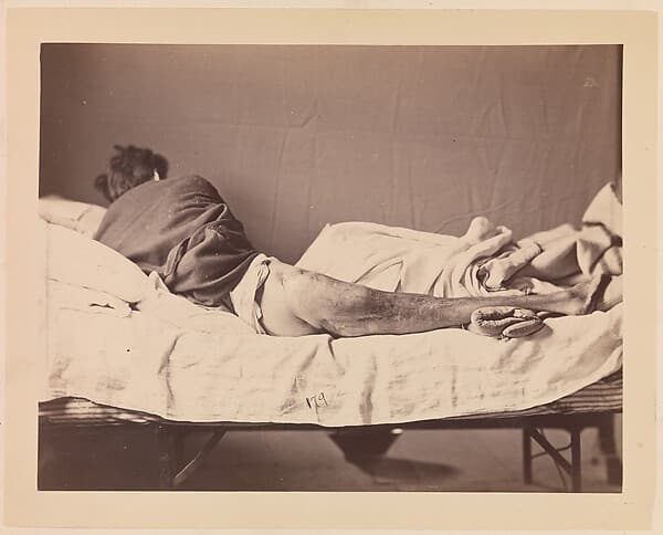 Private George Ruoss, Co. G, 7th New York Volunteers, by Reed Brockway Bontecou