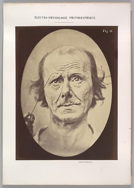 Figure 21: Painful recollection and recollection or calling something to mind, by Guillaume-Benjamin-Amand Duchenne de Boulogne