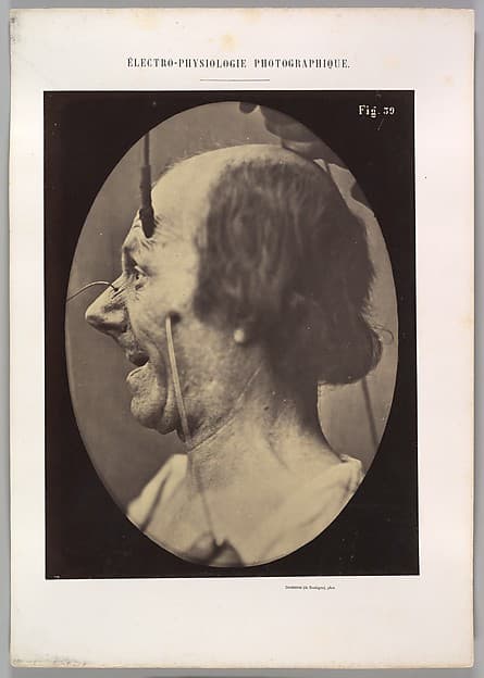Figure 39: The attention attracted by an object that provokes lascivious ideas and desires., by Guillaume-Benjamin-Amand Duchenne de Boulogne