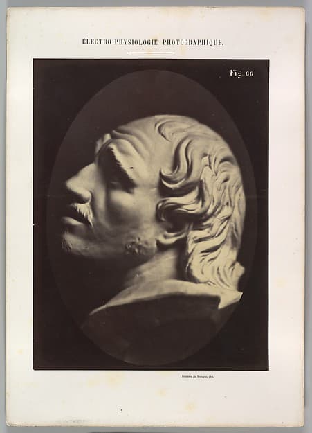 Figure 66: Head of Arrotino (the spy, the knife grinder, and so on), by Guillaume-Benjamin-Amand Duchenne de Boulogne