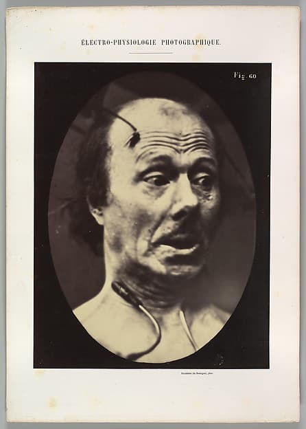 Figure 60: Fright, by Guillaume-Benjamin-Amand Duchenne de Boulogne
