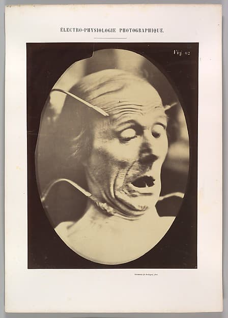 Figure 62: Terror, semiprofile, by Guillaume-Benjamin-Amand Duchenne de Boulogne
