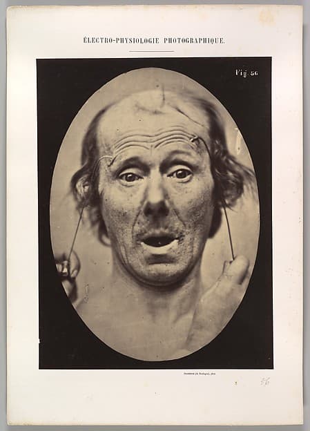 Figure 56: Surprise, by Guillaume-Benjamin-Amand Duchenne de Boulogne
